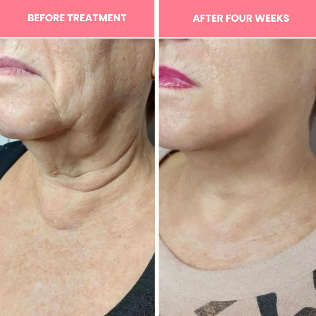 Vitaris Bio-Collagen Necklift Mask - Younger Neck After 1 Use