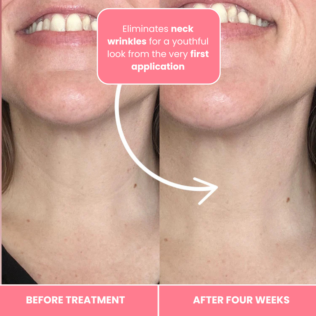 Vitaris Bio-Collagen Necklift Mask - Younger Neck After 1 Use