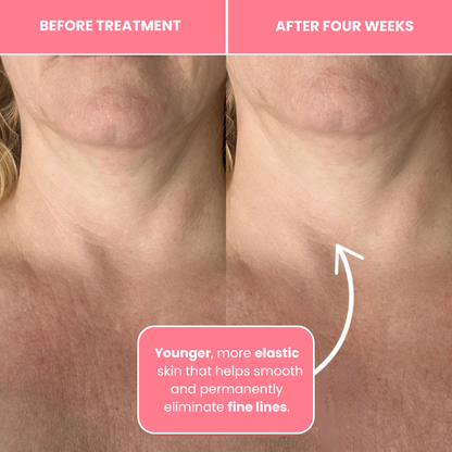 Vitaris Bio-Collagen Necklift Mask - Younger Neck After 1 Use