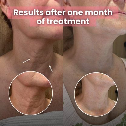 Vitaris Bio-Collagen Necklift Mask - Younger Neck After 1 Use